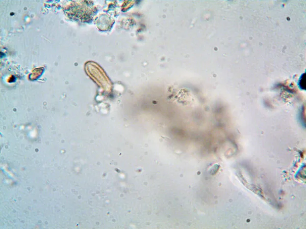 Lavabonun altındaki kirli suyun bakteri fotoğrafları.