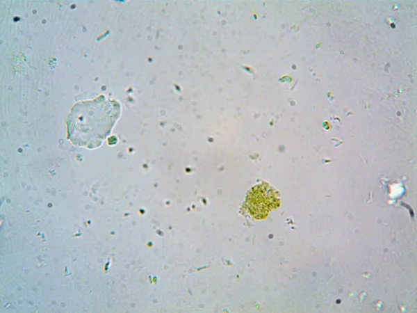 Lavabonun altındaki kirli suyun bakteri fotoğrafları.