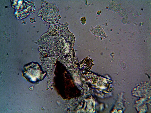Bilder Bakterier Från Smutsigt Vatten Vask — Stockfoto