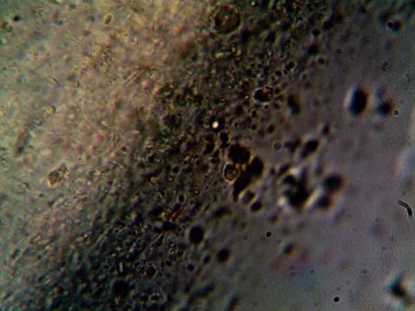 Lavabonun altındaki kirli suyun bakteri fotoğrafları.