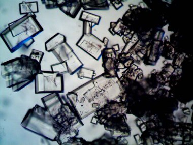 Mikroskopta görülen farklı kristalleşme aşamaları