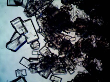 Mikroskopta görülen farklı kristalleşme aşamaları