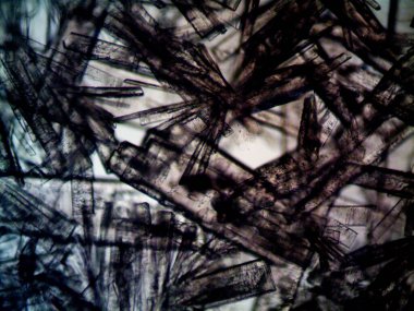 Mikroskopta görülen farklı kristalleşme aşamaları