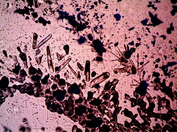 显微镜观察到晶化的不同阶段 — 图库照片