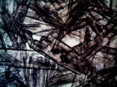 Mikroskopta görülen farklı kristalleşme aşamaları