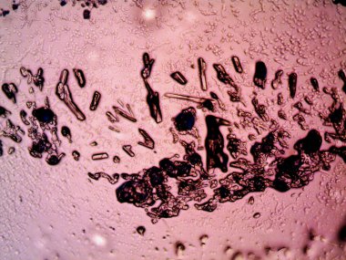 Mikroskopta görülen farklı kristalleşme aşamaları