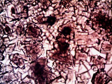 Mikroskopta görülen farklı kristalleşme aşamaları