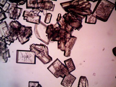 Mikroskopta görülen farklı kristalleşme aşamaları