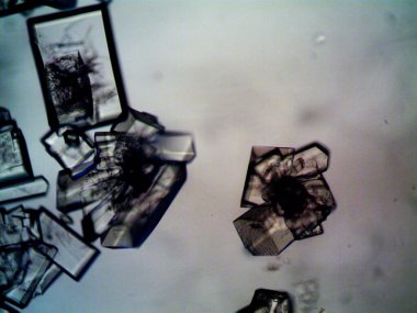 Mikroskopta görülen farklı kristalleşme aşamaları