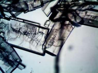 Mikroskopta görülen farklı kristalleşme aşamaları
