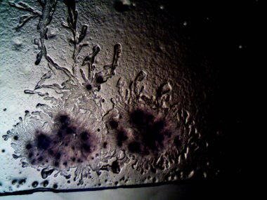 Mikroskopta görülen farklı kristalleşme aşamaları