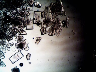 Mikroskopta görülen farklı kristalleşme aşamaları