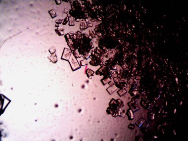 Mikroskopta görülen farklı kristalleşme aşamaları