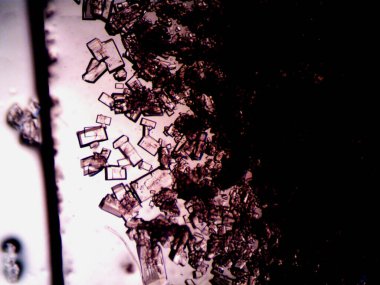 Mikroskopta görülen farklı kristalleşme aşamaları