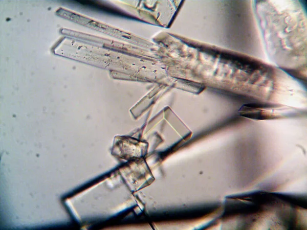 Estágios Difíceis Cristalização Vistos Microscópio — Fotografia de Stock