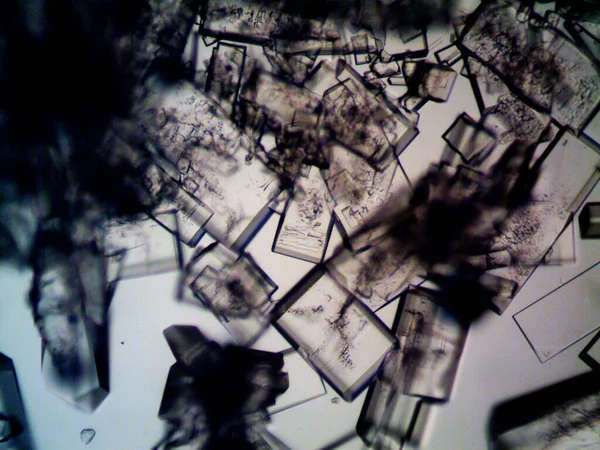 Mikroskopta görülen farklı kristalleşme aşamaları