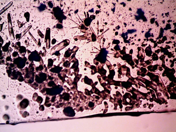 Différents Stades Cristalisation Observés Microscope — Photo