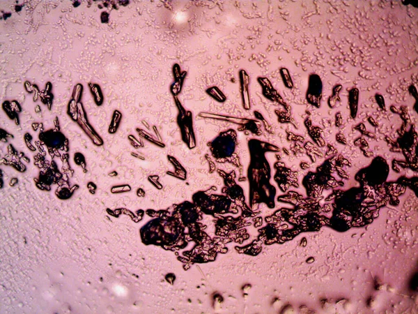 Diffra Stadier Kristallisering Ses Mikroskop — Stockfoto