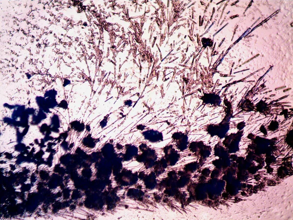 Diferentes Etapas Cristalización Observadas Microscopio — Foto de Stock