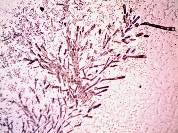 Diferentes Etapas Cristalización Observadas Microscopio — Foto de Stock