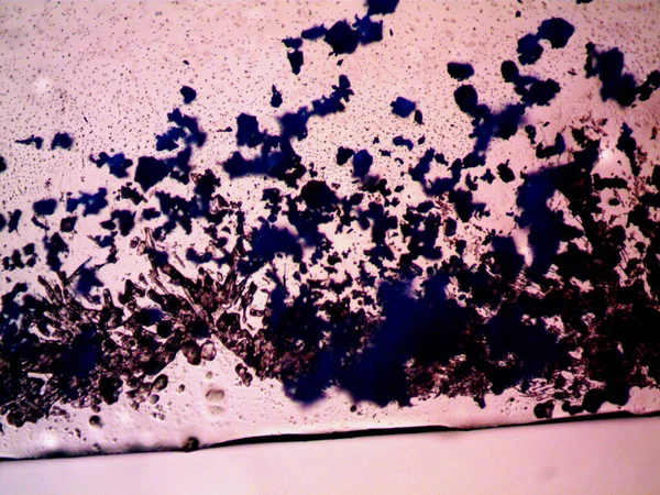 Дифференциальные Стадии Кристализации Видны Микроскопе — стоковое фото