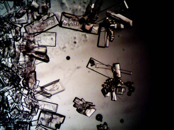 Різні Стадії Кристалізації Спостерігаються Мікроскопі — стокове фото