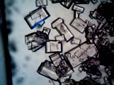 Mikroskopta görülen farklı kristalleşme aşamaları
