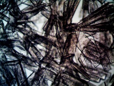 Mikroskopta görülen farklı kristalleşme aşamaları