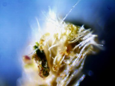 Mor limon mikroskobu x10