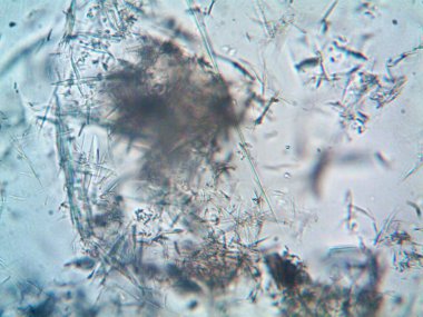 Birkaç reaksiyondan sonra kafein kristalinin fotoğrafı