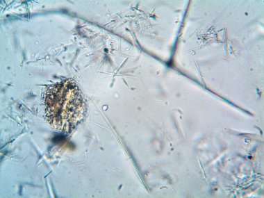 Birkaç reaksiyondan sonra kafein kristalinin fotoğrafı