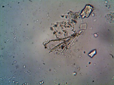 Birkaç reaksiyondan sonra kafein kristalinin fotoğrafı