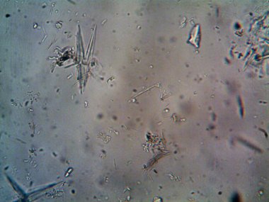 Birkaç reaksiyondan sonra kafein kristalinin fotoğrafı