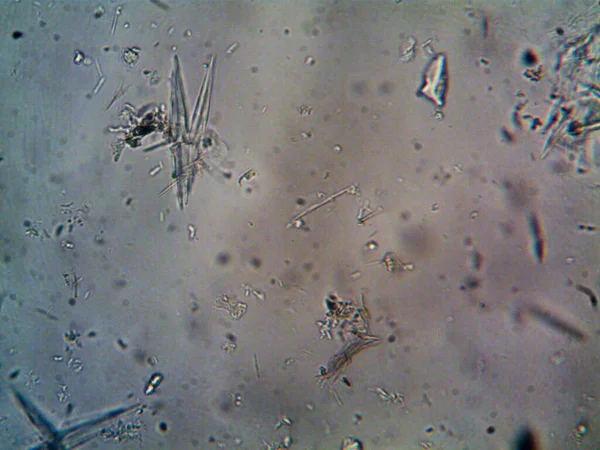 Birkaç reaksiyondan sonra kafein kristalinin fotoğrafı