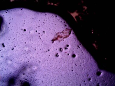 Mikroskop x100 'de görülen mikroorganizma