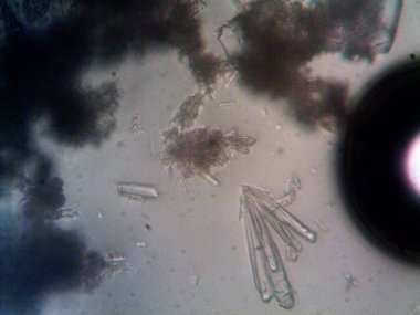 Mikroskop x100 'de görülen mikroorganizma