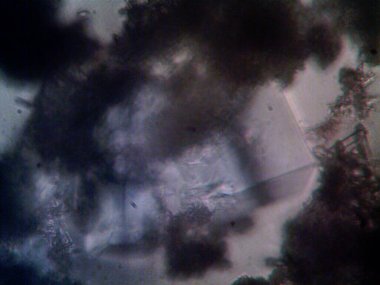 Mikroskop x100 'de görülen mikroorganizma