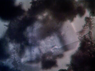 Mikroskop x100 'de görülen mikroorganizma