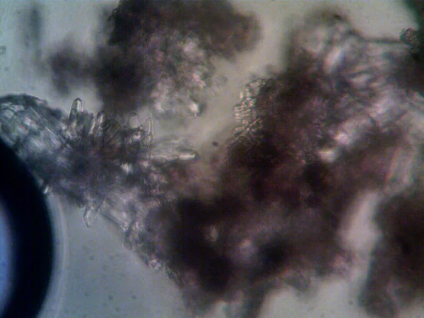 Mikroskop x100 'de görülen mikroorganizma