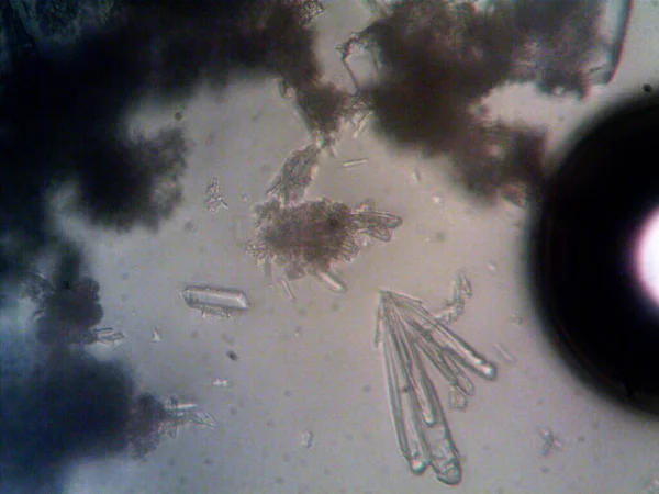 Mikroorganism Sedd Mikroskop X100 — Stockfoto
