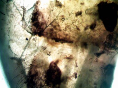 Mikroskop x100 'de görülen mikroorganizma