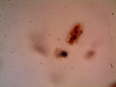 Mikroskop x100 'de görülen mikroorganizma