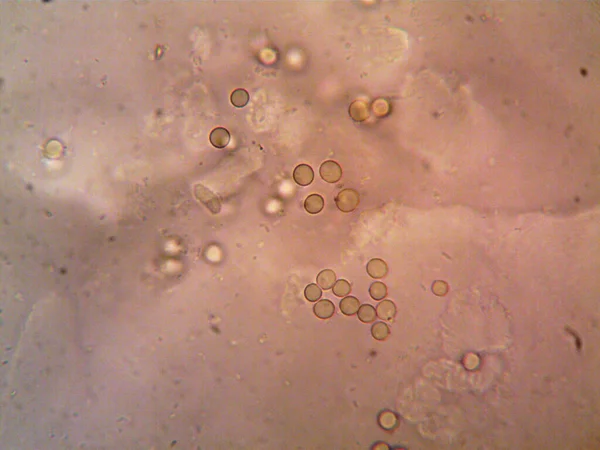 Microorganismo Visto Microscopio X100 —  Fotos de Stock