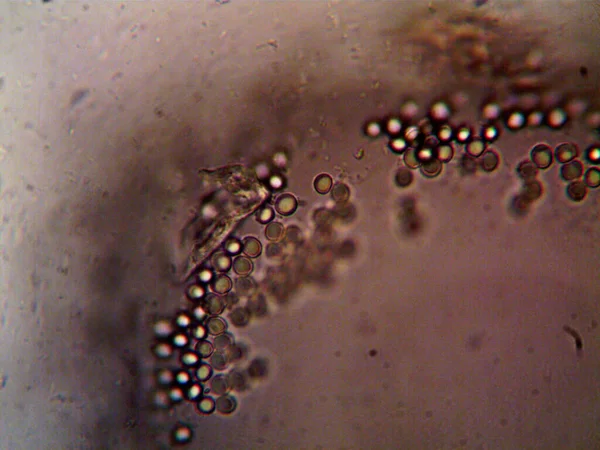 Microorganismo Visto Microscopio X100 — Foto de Stock