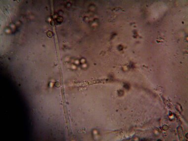 Mikroskop x100 'de görülen mikroorganizma