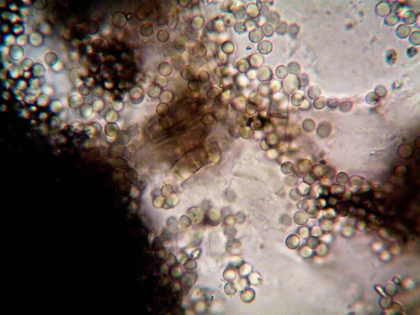 Микроорганизм Микроскопом X100 — стоковое фото