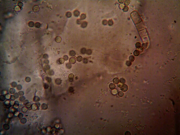 Microorganismo Visto Microscopio X100 — Foto de Stock