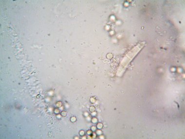 Mikroskop x100 'de görülen mikroorganizma