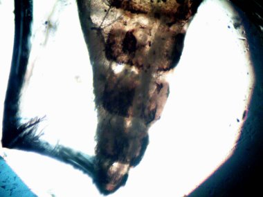 Mikroskop x100 'de görülen mikroorganizma