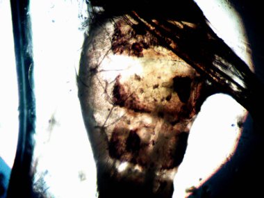 Mikroskop x100 'de görülen mikroorganizma